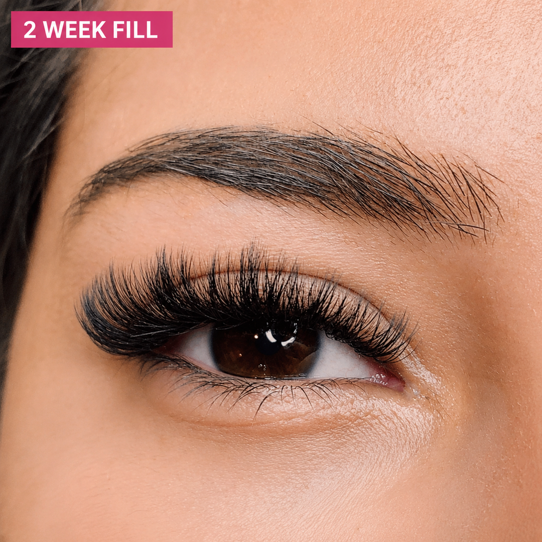 Volume Fill – 2 Weeks