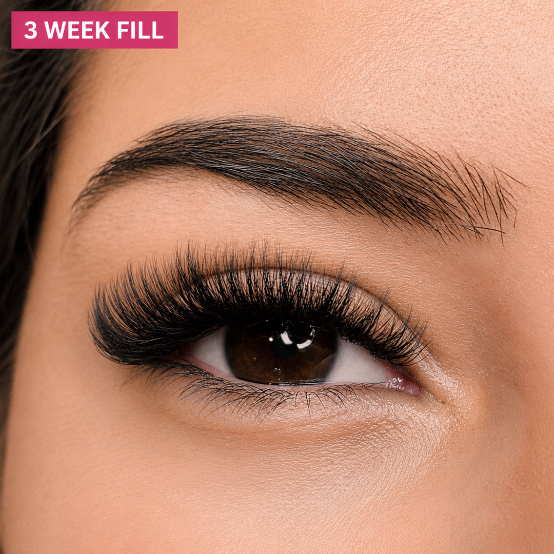 Volume Fill – 3 Weeks
